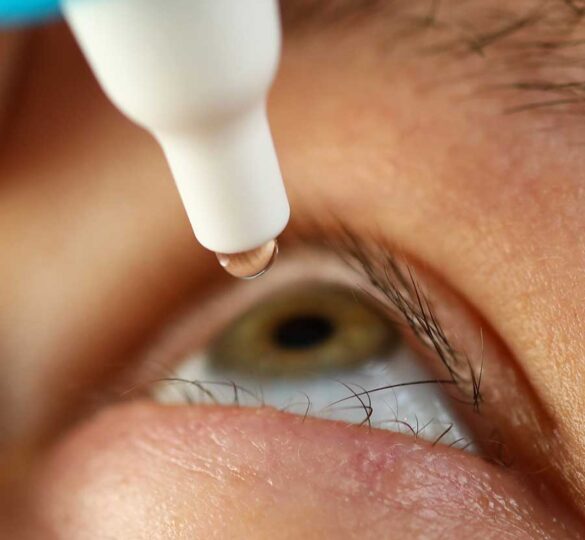 Glaucoma Eye Drops: Suggestions On Use
