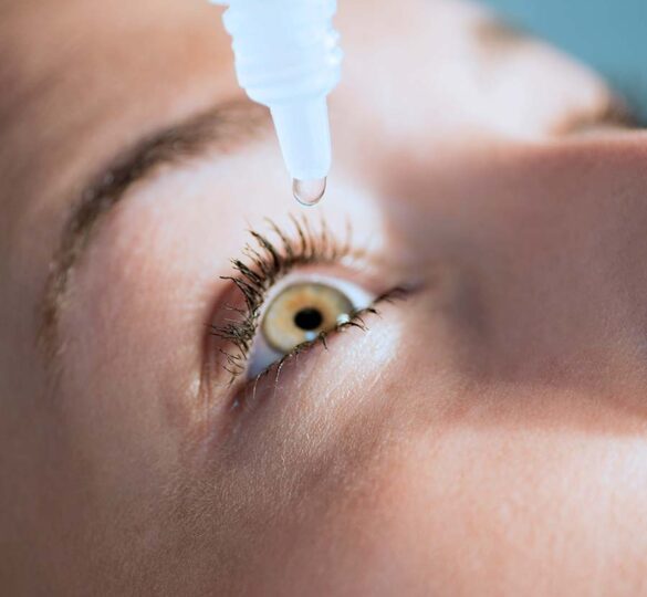 Ojos Secos Y Glaucoma: Doble Problema