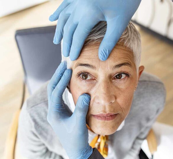 Cómo Afecta Glaucoma Al Nervio Óptico
