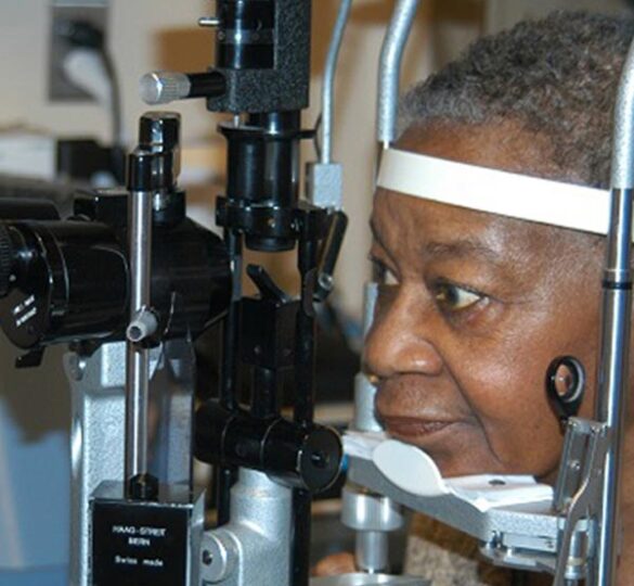 Presión Ocular Elevada Y Glaucoma