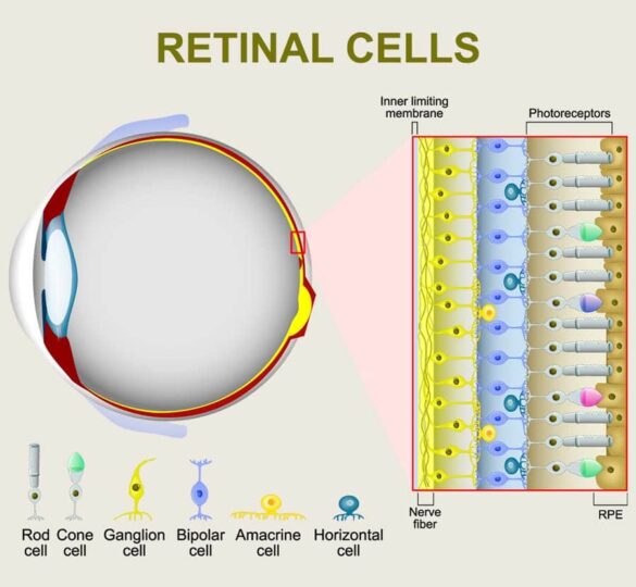 Research On Retinal Pigment Epithelial (Rpe) Cells Promises New Future Treatment For Glaucoma Patients