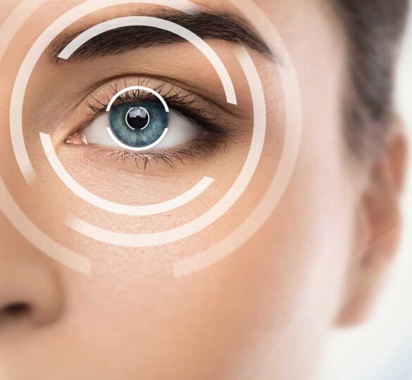 Nuevos Sistemas De Administración De Medicamentos Para El Glaucoma