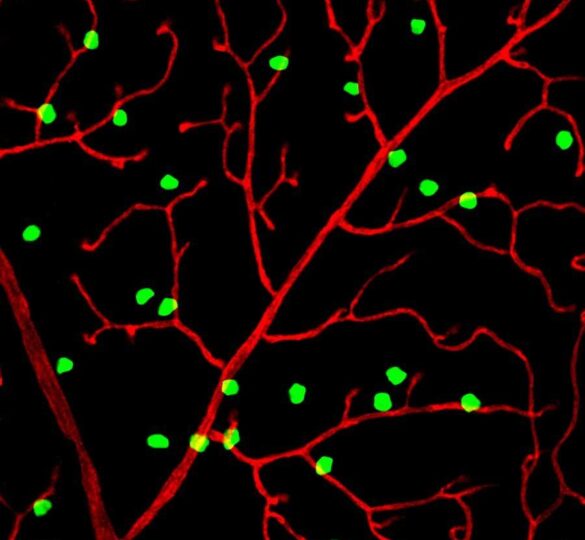 New Research From Grf-Funded Investigators Reports Discovery Of New Type Of Neuron In The Eye