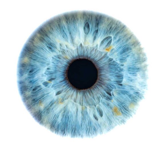 ¿Puede la presión ocular bajar demasiado? 2 What is Charles Bonnet Syndrome?