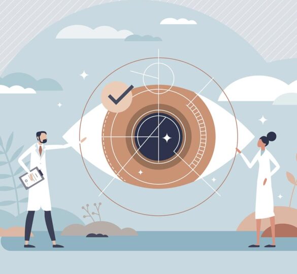 Laser vision correction concept illustration