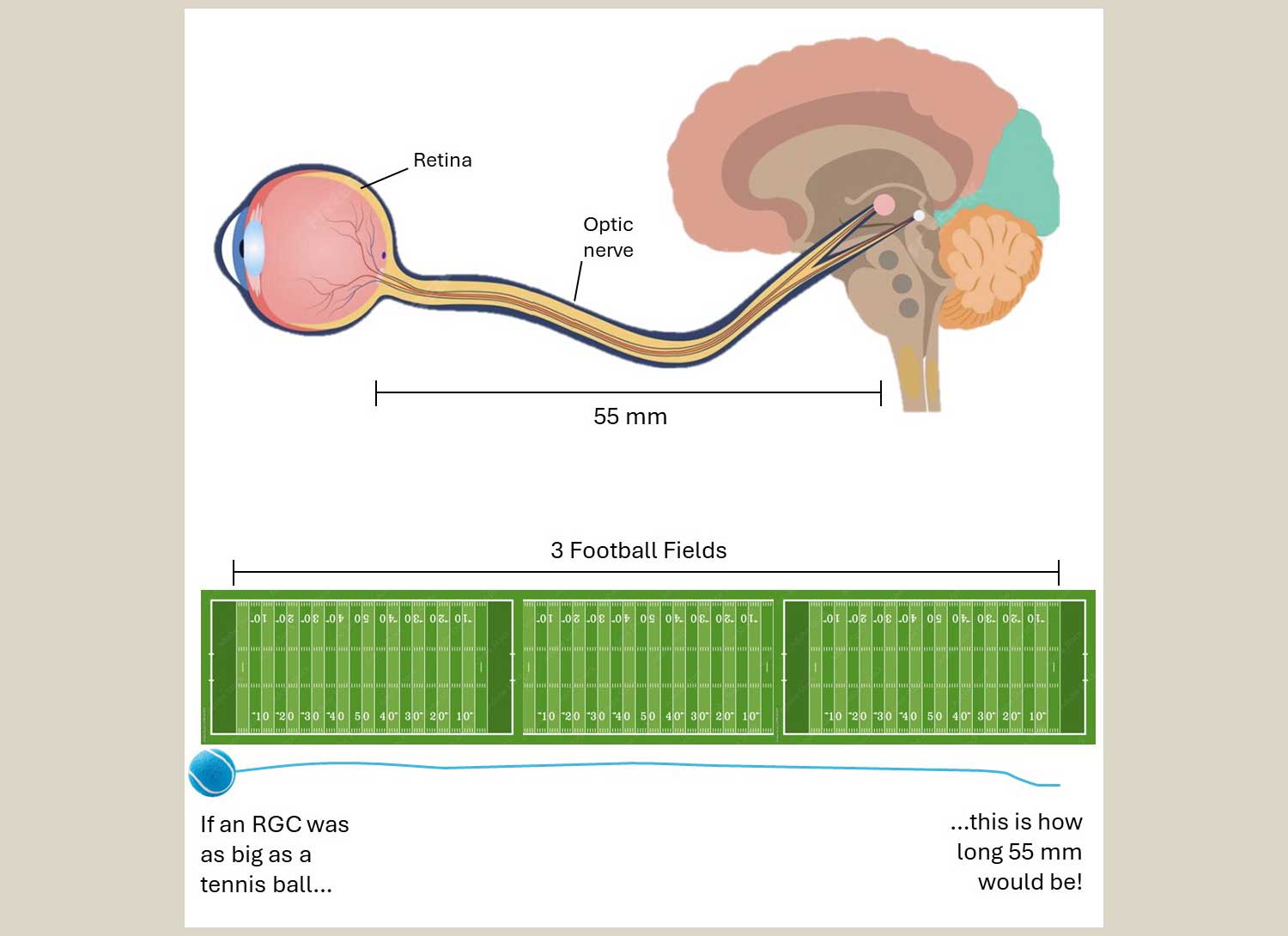 The Powerhouse Of Vision: How Mitochondria Are Linked To Glaucoma 1 Mitochondria Article Figure 1A
