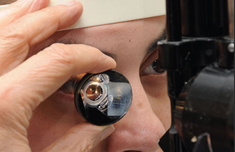 Deteccion De Glaucoma 4 Goniocsopy